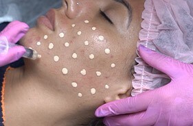 bb11 - Domine o BB Glow com nosso curso online. Aprenda técnicas de rejuvenescimento facial. Transforme-se agora!